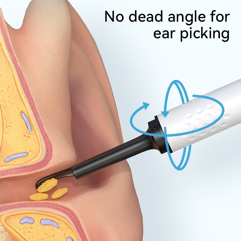 비디오 카메라용 귀 청소기, 귀지 청소용 이어스코프,  - Health Power Tools 리뷰 및 가격